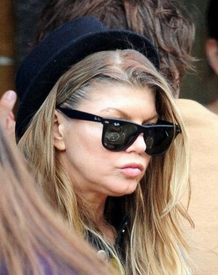 Fergie's disgusting face